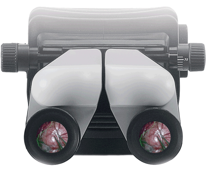 Premium Surgical Microscope M530 OHX - Image 3