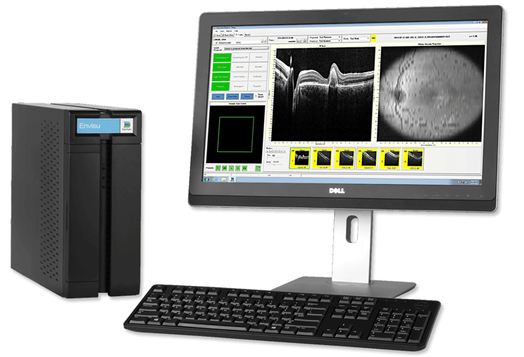 OCT for Ophthalmology Envisu C-Class - Image 2